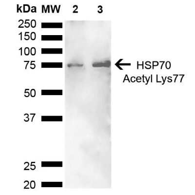 Western Blot: HSP70/HSPA1A [ac Lys77] Antibody [NBP2-61122]